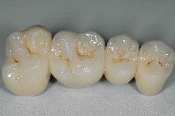 0046-gross.jpg