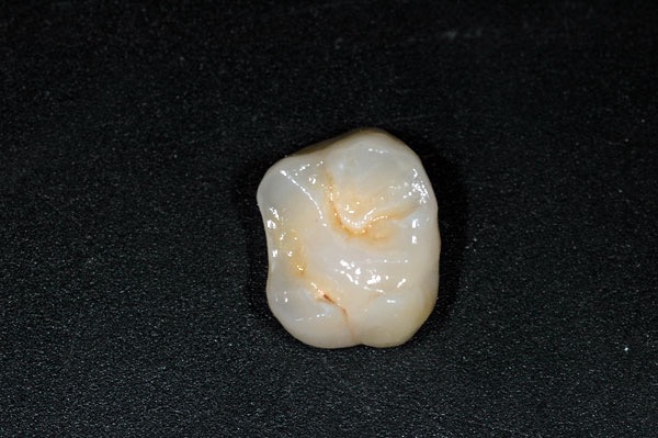 0108-gross.jpg