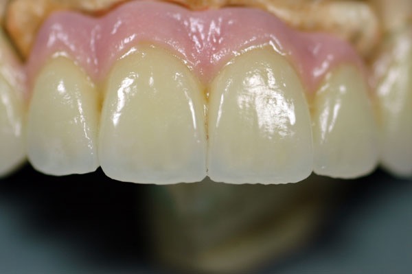 1004-gross.jpg